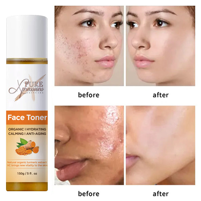 Turmeric Face Toner