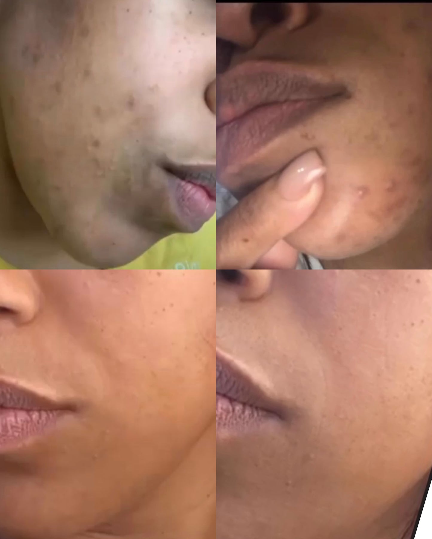 ✨ Pure All Day – Everyday Facial Kit